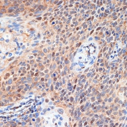 Invitrogen CDK2 Polyclonal Antibody 100 &mu;L; Unconjugated:Antibodies,