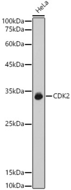 Invitrogen CDK2 Polyclonal Antibody 100 &mu;L; Unconjugated:Antibodies,