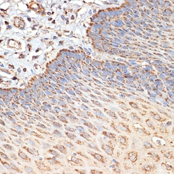 Invitrogen TSC2 Polyclonal Antibody 100 &mu;L; Unconjugated:Antibodies,