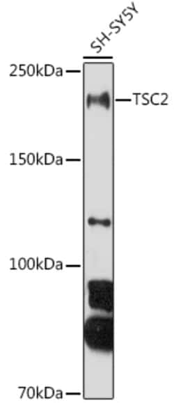 Invitrogen TSC2 Polyclonal Antibody 100 &mu;L; Unconjugated:Antibodies,