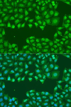 Invitrogen SSB Polyclonal Antibody 100 &mu;L; Unconjugated:Antibodies,