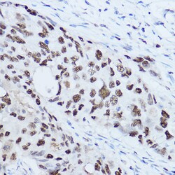Invitrogen SSB Polyclonal Antibody 100 &mu;L; Unconjugated:Antibodies,