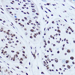 Invitrogen SSB Polyclonal Antibody 100 &mu;L; Unconjugated:Antibodies,