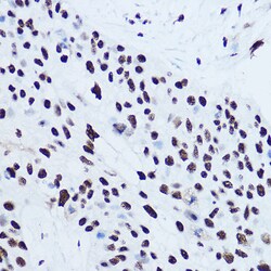 Invitrogen SSB Polyclonal Antibody 100 &mu;L; Unconjugated:Antibodies,