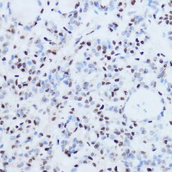 Invitrogen SSB Polyclonal Antibody 100 &mu;L; Unconjugated:Antibodies,