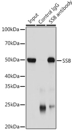 Invitrogen SSB Polyclonal Antibody 100 &mu;L; Unconjugated:Antibodies,