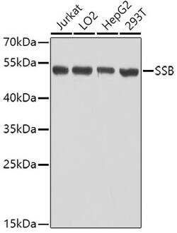 Invitrogen SSB Polyclonal Antibody 100 &mu;L; Unconjugated:Antibodies,