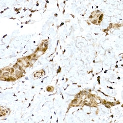 Invitrogen Nrf2 Polyclonal Antibody 100 &mu;L; Unconjugated:Antibodies,