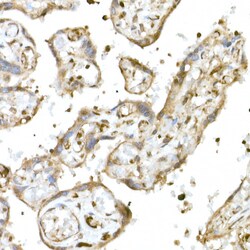 Invitrogen Nrf2 Polyclonal Antibody 100 &mu;L; Unconjugated:Antibodies,