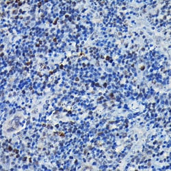 Invitrogen C/EBP beta Polyclonal Antibody 100 &mu;L; Unconjugated:Antibodies,