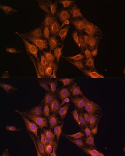 Invitrogen NF2 Polyclonal Antibody 100 &mu;L; Unconjugated:Antibodies,