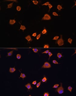 Invitrogen NF2 Polyclonal Antibody 100 &mu;L; Unconjugated:Antibodies,