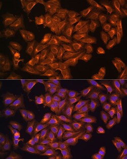 Invitrogen NF2 Polyclonal Antibody 100 &mu;L; Unconjugated:Antibodies,