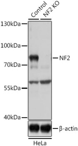 Invitrogen NF2 Polyclonal Antibody 100 &mu;L; Unconjugated:Antibodies,