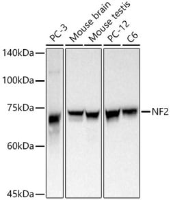 Invitrogen NF2 Polyclonal Antibody 100 &mu;L; Unconjugated:Antibodies,