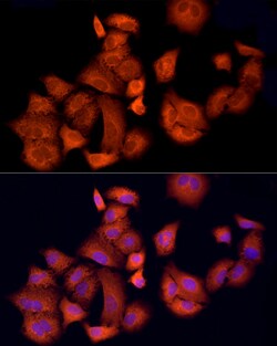 Invitrogen APAF1 Polyclonal Antibody 100 &mu;L; Unconjugated:Antibodies,