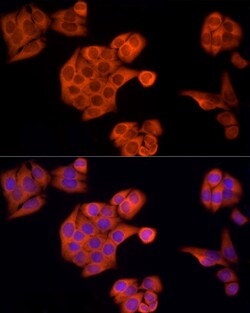 Invitrogen APAF1 Polyclonal Antibody 100 &mu;L; Unconjugated:Antibodies,