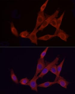 Invitrogen APAF1 Polyclonal Antibody 100 &mu;L; Unconjugated:Antibodies,