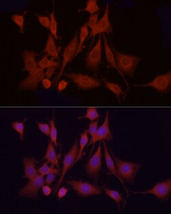 Invitrogen APAF1 Polyclonal Antibody 100 &mu;L; Unconjugated:Antibodies,