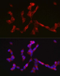 Invitrogen ALK Polyclonal Antibody 100 &mu;L; Unconjugated:Antibodies,