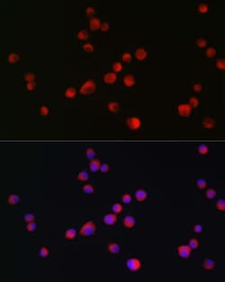 Invitrogen ALK Polyclonal Antibody 100 &mu;L; Unconjugated:Antibodies,