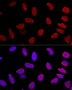 Invitrogen Ku70 Polyclonal Antibody 100 &mu;L; Unconjugated:Antibodies,