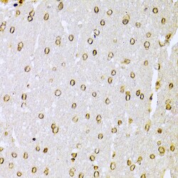 Invitrogen Ku70 Polyclonal Antibody 100 &mu;L; Unconjugated:Antibodies,