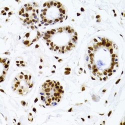 Invitrogen Ku70 Polyclonal Antibody 100 &mu;L; Unconjugated:Antibodies,