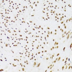 Invitrogen Ku70 Polyclonal Antibody 100 &mu;L; Unconjugated:Antibodies,