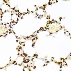 Invitrogen Ku70 Polyclonal Antibody 100 &mu;L; Unconjugated:Antibodies,