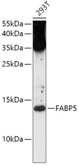 Invitrogen FABP5 Polyclonal Antibody 100 &mu;L; Unconjugated:Antibodies,