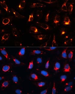 Cytokeratin 18 Polyclonal Antibody, Invitrogen 100 &mu;L; Unconjugated:Antibodies,