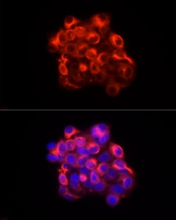 Cytokeratin 18 Polyclonal Antibody, Invitrogen 100 &mu;L; Unconjugated:Antibodies,