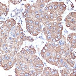 Cytokeratin 18 Polyclonal Antibody, Invitrogen 100 &mu;L; Unconjugated:Antibodies,