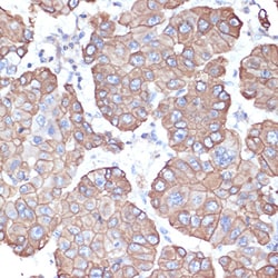 Cytokeratin 18 Polyclonal Antibody, Invitrogen 100 &mu;L; Unconjugated:Antibodies,