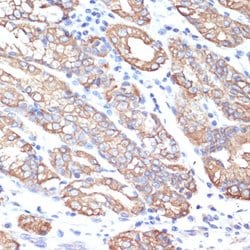 Cytokeratin 18 Polyclonal Antibody, Invitrogen 100 &mu;L; Unconjugated:Antibodies,