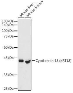 Cytokeratin 18 Polyclonal Antibody, Invitrogen 100 &mu;L; Unconjugated:Antibodies,