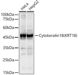 Cytokeratin 18 Polyclonal Antibody, Invitrogen 100 &mu;L; Unconjugated:Antibodies,