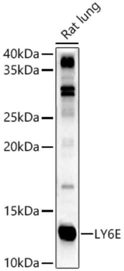Invitrogen Ly-6E Polyclonal Antibody 100 &mu;L; Unconjugated:Antibodies,