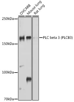 Invitrogen PLCB3 Polyclonal Antibody 100 &mu;L; Unconjugated:Antibodies,