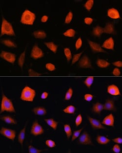 Invitrogen eIF2b epsilon Polyclonal Antibody 100 &mu;L | Buy Online | Invitrogen&trade; | Fisher Scientific