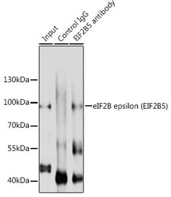Invitrogen eIF2b epsilon Polyclonal Antibody 100 &mu;L | Buy Online | Invitrogen&trade; | Fisher Scientific