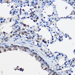 Invitrogen SRC2 Polyclonal Antibody 100 &mu;L; Unconjugated:Antibodies,