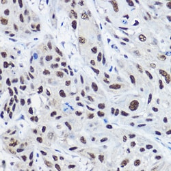 Invitrogen SRC2 Polyclonal Antibody 100 &mu;L; Unconjugated:Antibodies,