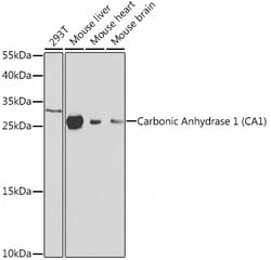 Invitrogen™ Carbonic Anhydrase I Polyclonal Antibody