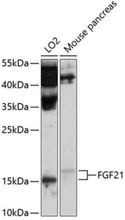 Invitrogen FGF21 Polyclonal Antibody 100 &mu;L; Unconjugated:Antibodies,