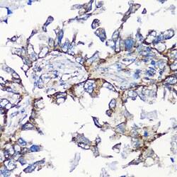 Invitrogen MMP16 Polyclonal Antibody 100 &mu;L | Buy Online | Invitrogen&trade; | Fisher Scientific