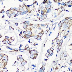 Invitrogen MMP16 Polyclonal Antibody 100 &mu;L | Buy Online | Invitrogen&trade; | Fisher Scientific
