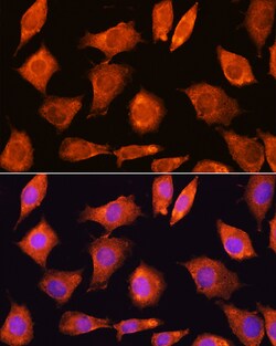 Invitrogen SEC11A Polyclonal Antibody 100 &mu;L; Unconjugated:Antibodies,