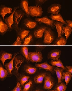 Invitrogen SEC11A Polyclonal Antibody 100 &mu;L; Unconjugated:Antibodies,
